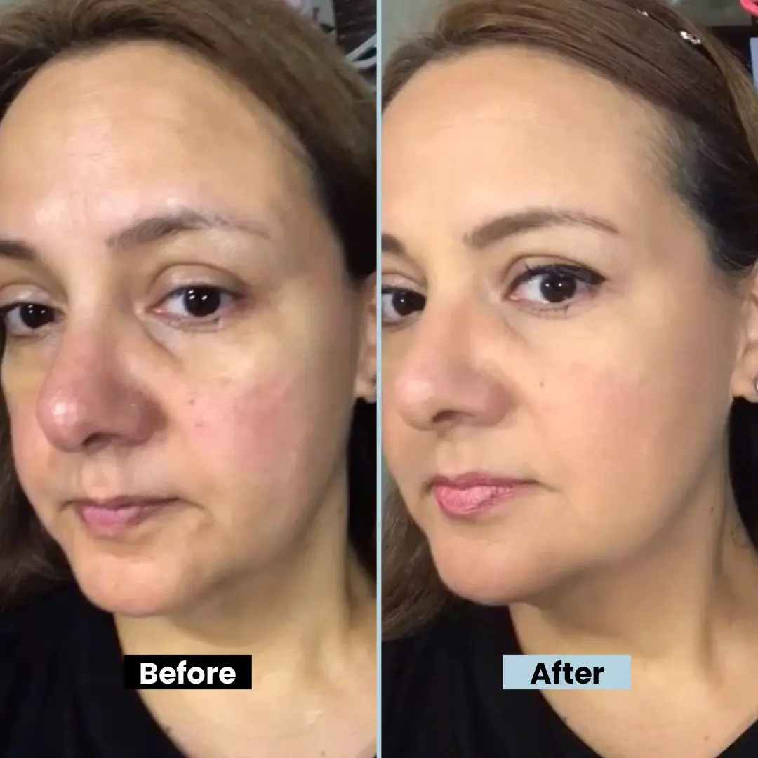 before_and_after_fc610386-0593-474e-9af9-fde4c96384e6